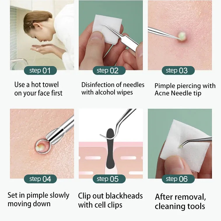 ClearSkin Precision Kit™